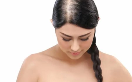 Women's Hair Loss