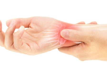 Rheumatoid Arthritis