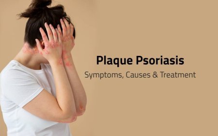 Plaque Psoriasis