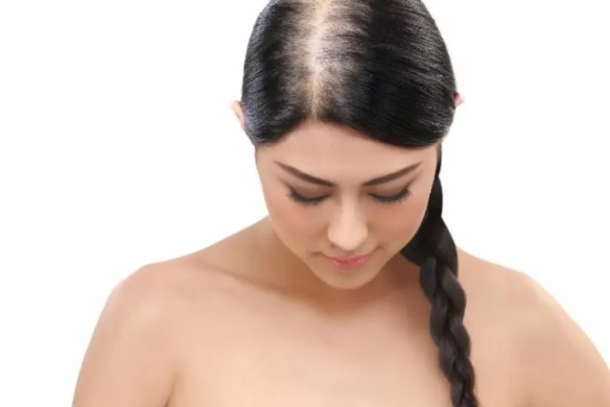 Women's Hair Loss