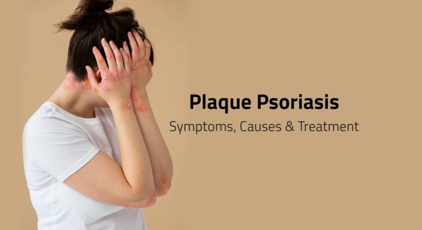 Plaque Psoriasis