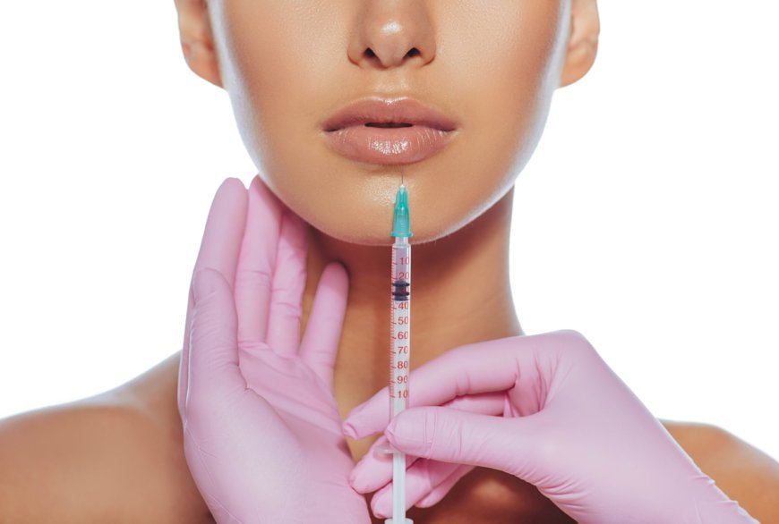 Dermal Fillers