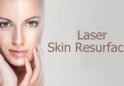 Laser Skin Resurfacing