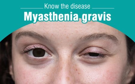 Myasthenia Gravis
