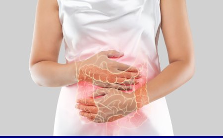 Ulcerative Colitis