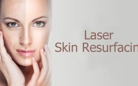 Laser Skin Resurfacing