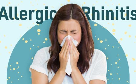 Allergic Rhinitis