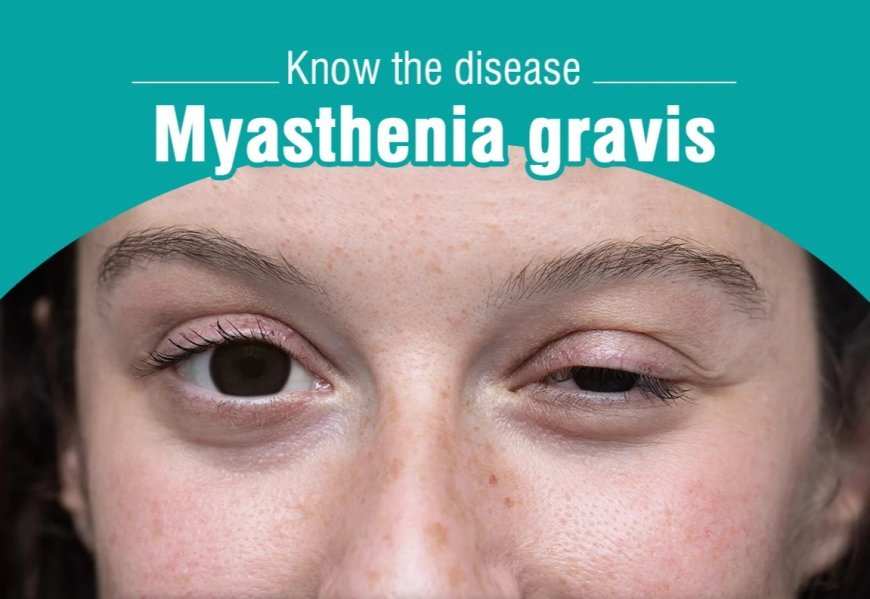 Myasthenia Gravis