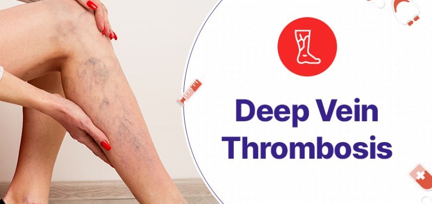 Deep Vein Thrombosis