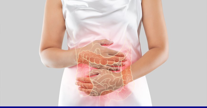 Ulcerative Colitis