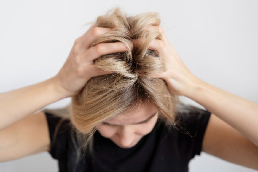 Dry Scalp Causes